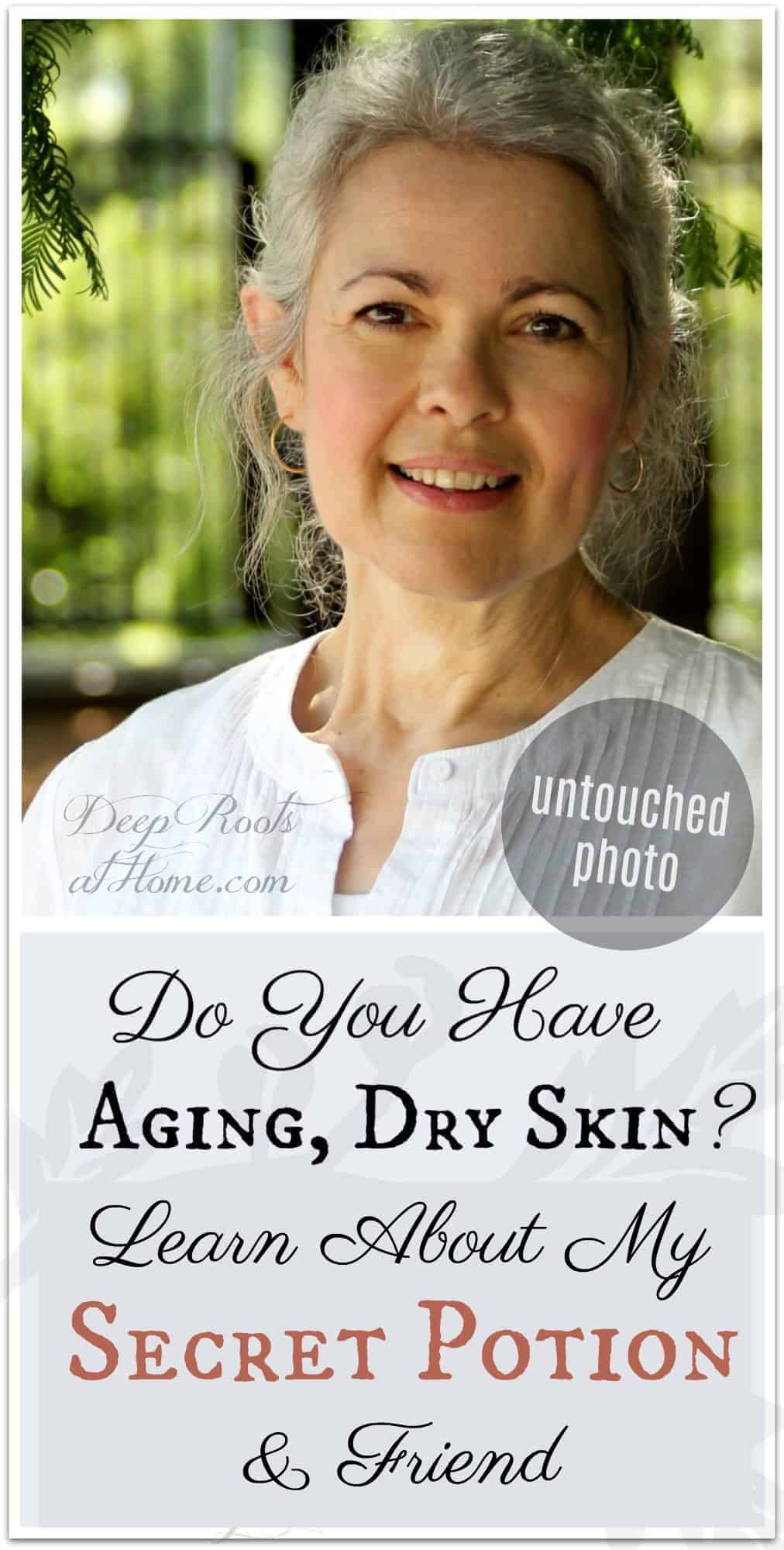 Do You Have Aging, Dry Skin? Introducing My Secret Potion & Friend. aging