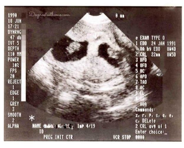 Our ultrasound.