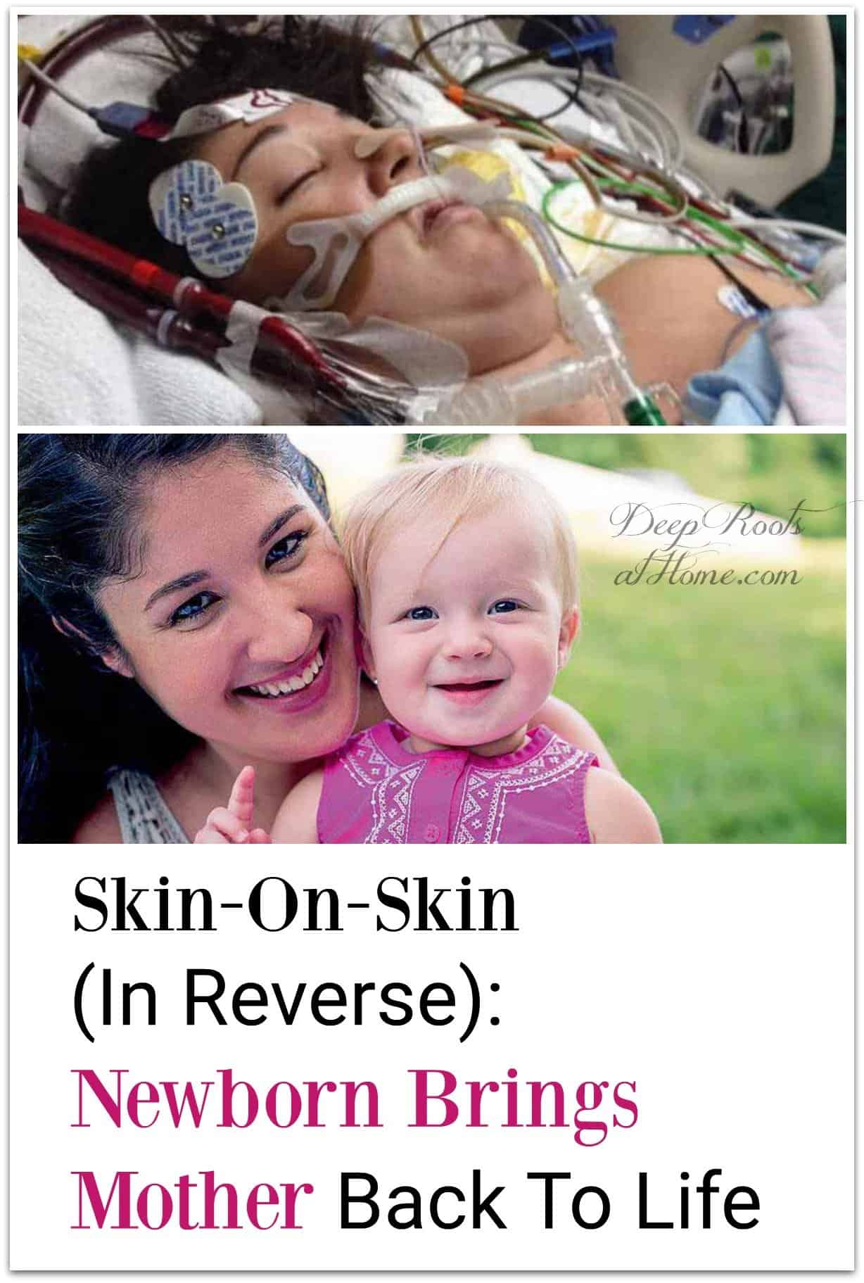 Skin-On-Skin In Reverse: Newborn Brings Mother Back To Life. comatose mother Pinterest image