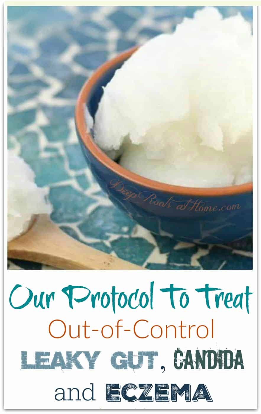 Our Protocol To Treat Out-of-Control Leaky Gut, Candida & Eczema. coconut oil in a bowl