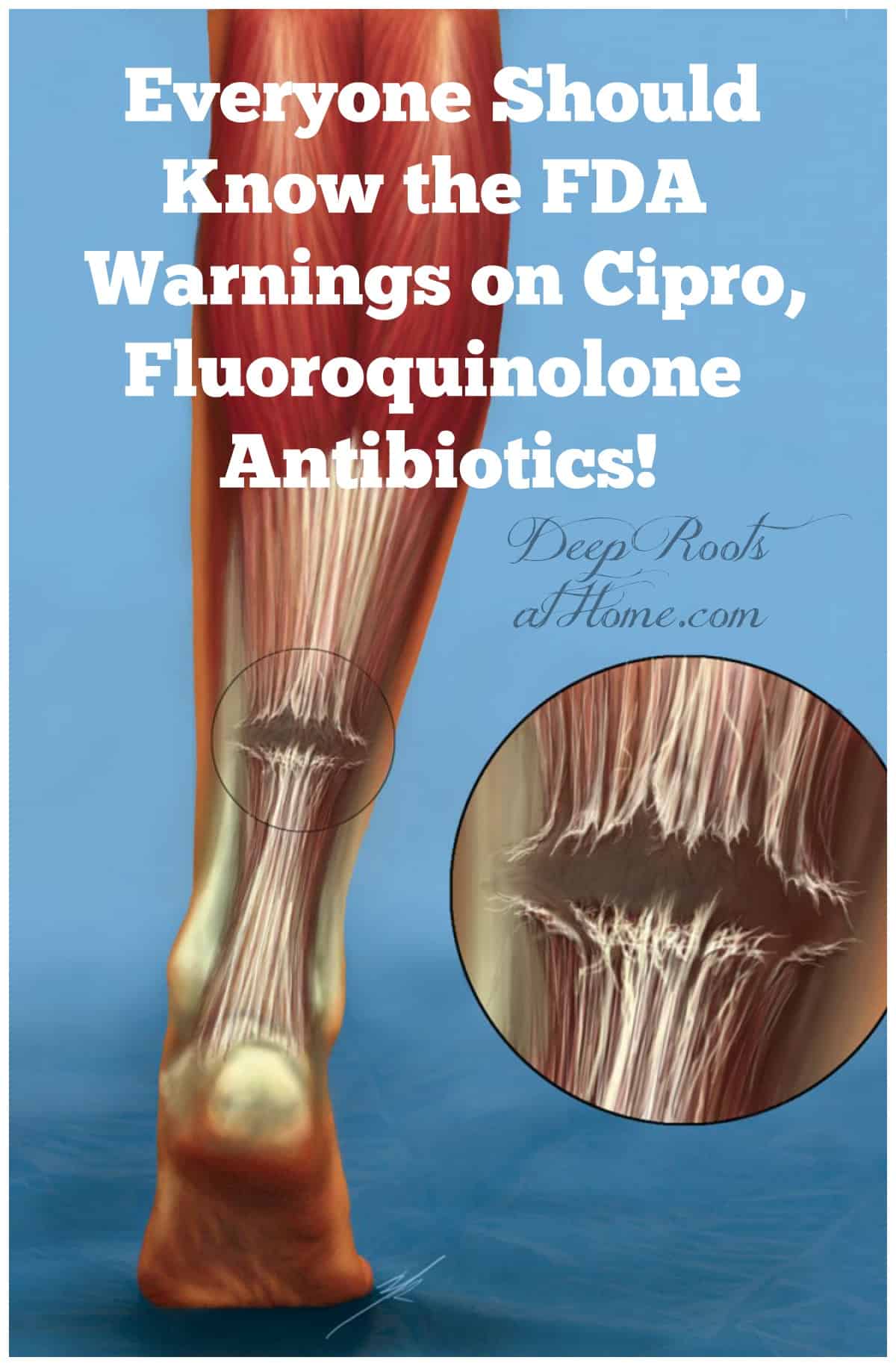 Medical Alert: Know the Warnings on Cipro, Fluoroquinolone Antibiotics. The author in a hospital bed. She has had 20 surgeries from damage caused by Cipro.