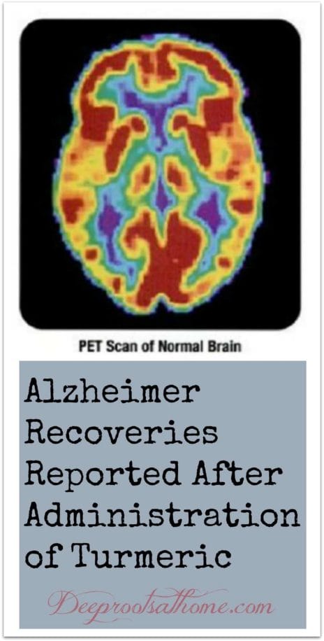 Alzheimer Recoveries Reported After Administration of Turmeric, cognitive powers, spice of remembrance, spice islands, Kate Humble, quote, turmeric, spice, powder, root, Bulk Herb Store, melanoma, liver detox, Lilly's green and white pills, weight management, chemo enhancer, curcumin, capsule making machine, world's healthiest foods, herbal remedies, lost healing arts, disease, restoring health, cancer, Alzheimer's, anti-inflammatory, health benefits, DIY, homemaking, homemaker, keeper at home, healthy living, medicine cabinet, natural medicine, alternative medicine, make your own capsules, anti-depressents, Big Pharma, drug dependence, suicide, link to autism, scientific studies, herbs, plants, naturally-occurring remedies, terrible side-effects, pharmaceuticals, Alzheimer-prevention, painkiller, natural mood elevator, mask symptoms, Sexual dysfunction, reduced sex drive, impotence, premature birth, autism, Prozac Addiction, research science, India, no-side-effects, medications, side benefits, physiological pathways, the body, high margin of safety, chemotherapy agents, potential for healing, FDA approval, patentability, profitability, American history, Declaration of Independence, Congress, natural substances, patent protection, search and review, National Library of Medicine, bibliographic database, PubMed, polyphenol, Cancer Stem Cells, Protecting Against Radiation, Liver Disease, Liver Cancer Preventing, pharmaceutical industry revenue, knowledge, drugging America, disclaimer, pre-made turmeric Capsules, make my own, DIY, organic turmeric, capsule machine, safe natural alternatives, 