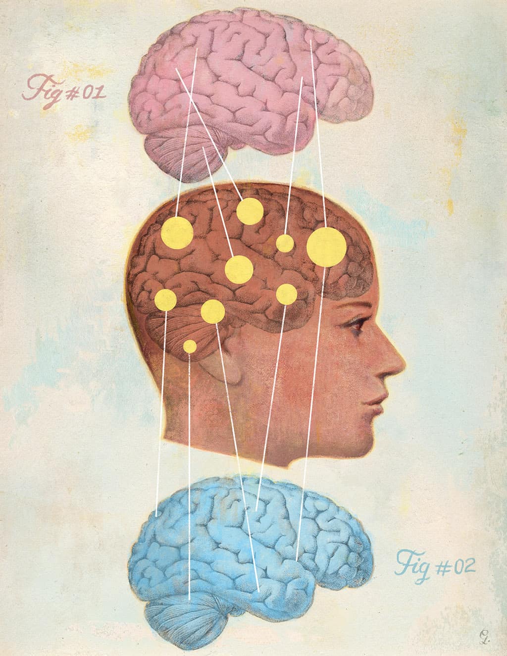 4 Brain Differences Between Boys & Girls: Why They Act/ Think Differently. An illustration of the areas of the brains that are dominant in girls and those in boys.