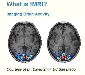 Storytime Science: What Happens In Your Child's Brain When You Read? Brain scan of the head with an MRI 