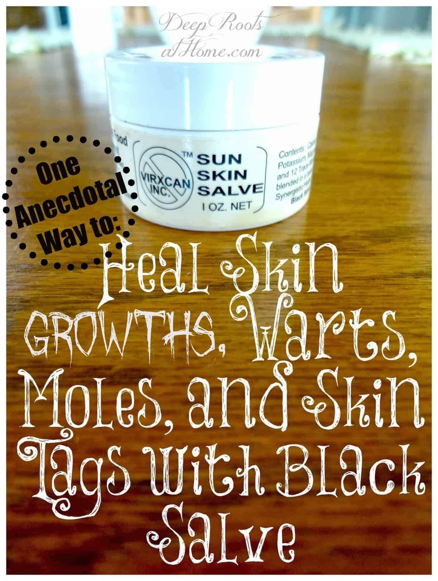 Black Salve: Anecdotal Healing Skin Growths, Warts, Moles & Skin Tags. A small jar of Virxcan Sun Skin Salve
