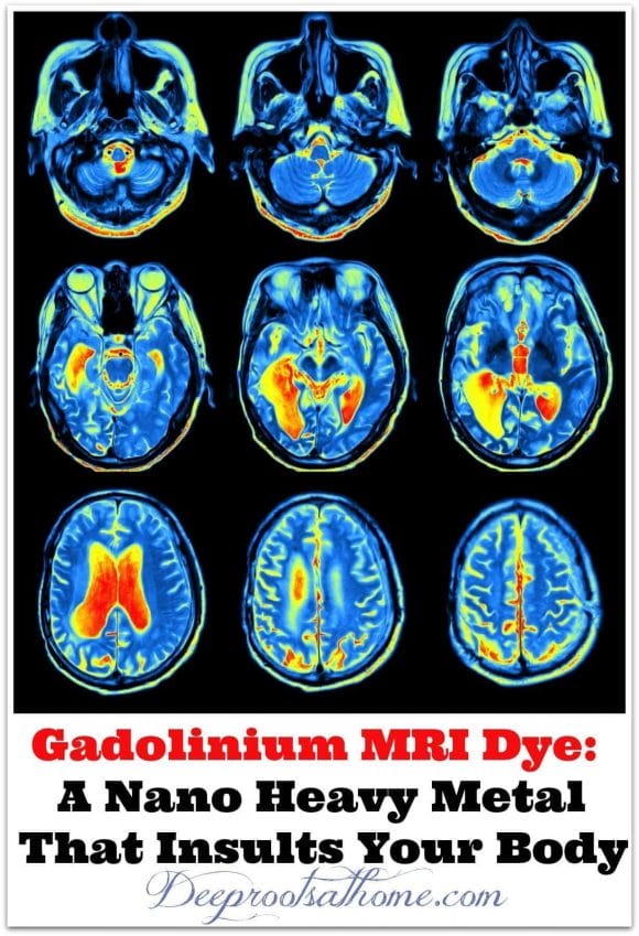Gadolinium MRI Dye: A Nano Heavy Metal That Insults Your Body, contrast dye in a brain