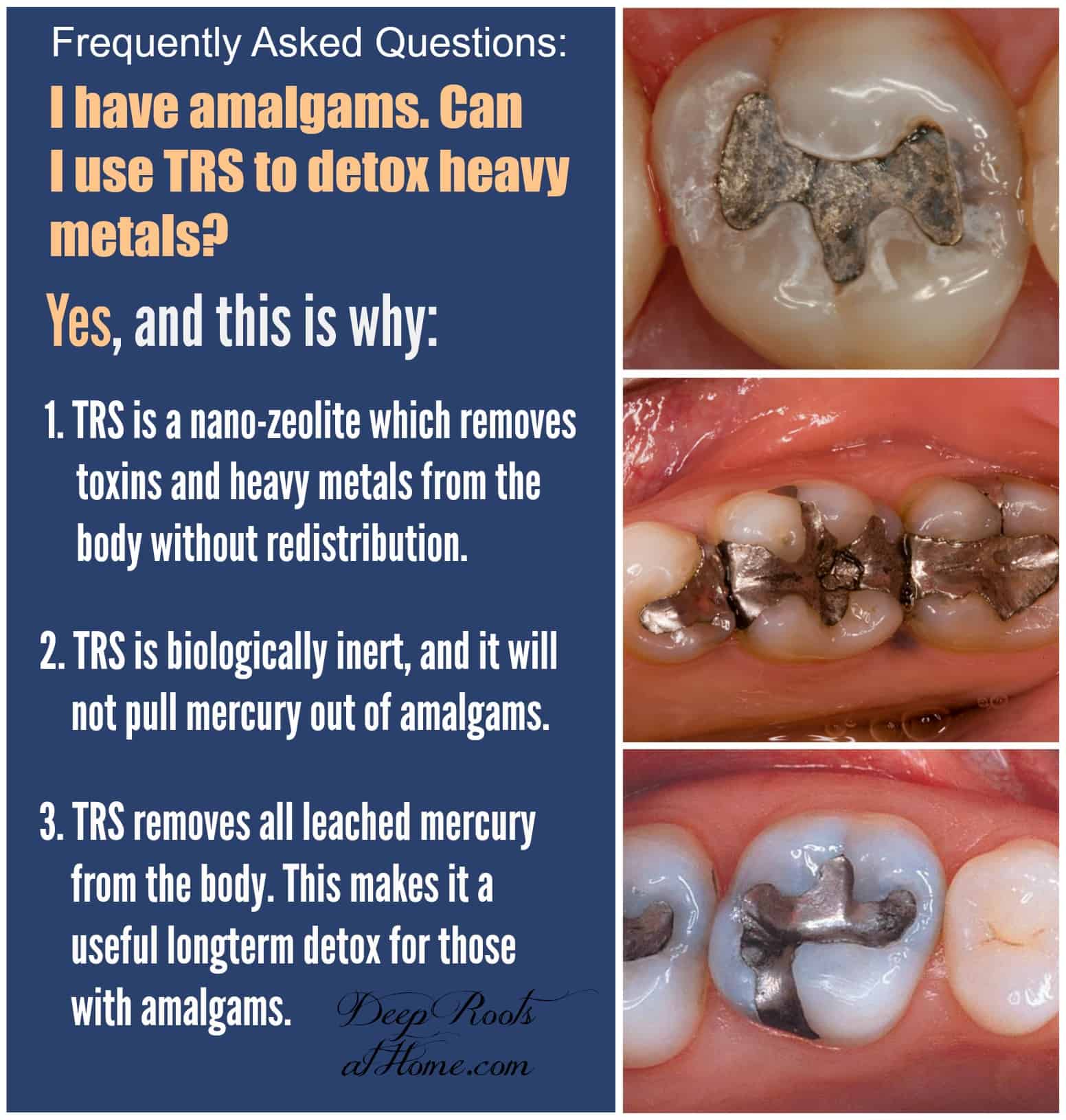 OffGassing Teeth Video Evidence Dental Amalgams Are Toxic