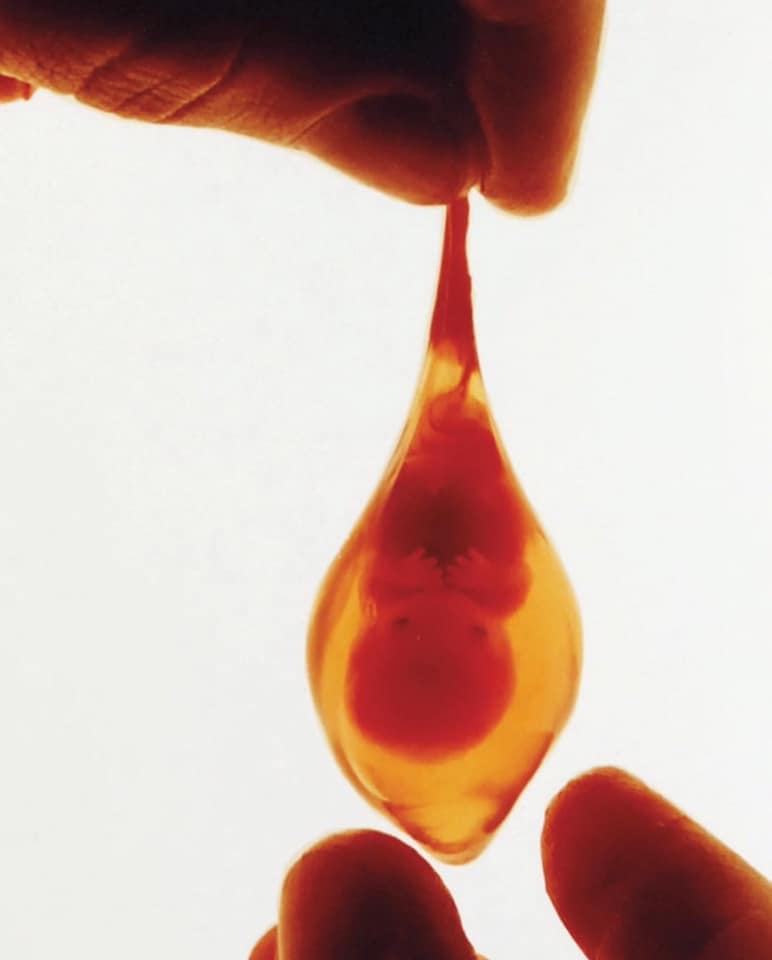Are Your Ready To Meet the Babies In Your Next Vaccines? placental sac