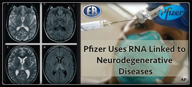 Tiny Holes in the Brain: Is the Spike Protein is a Source of Prion Disease? 