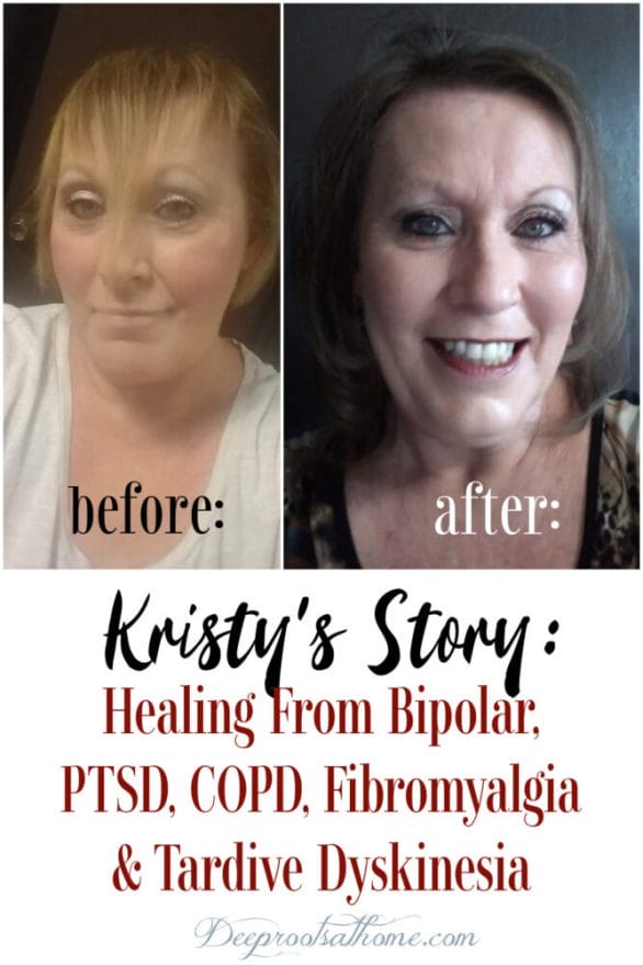 Kristy's Story: Healing From Bipolar, PTSD, COPD, Fibromyalgia & TD