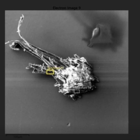 Crazy Objects Found in Blood of the Vaccinated & In Vaccine Vials