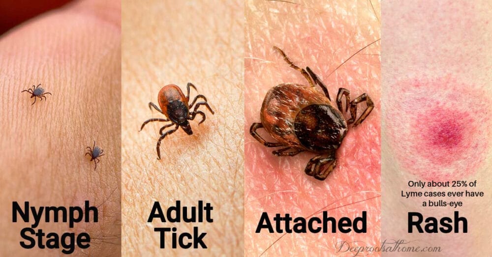 What To Do Immediately For Lyme Disease After A Tick Bite