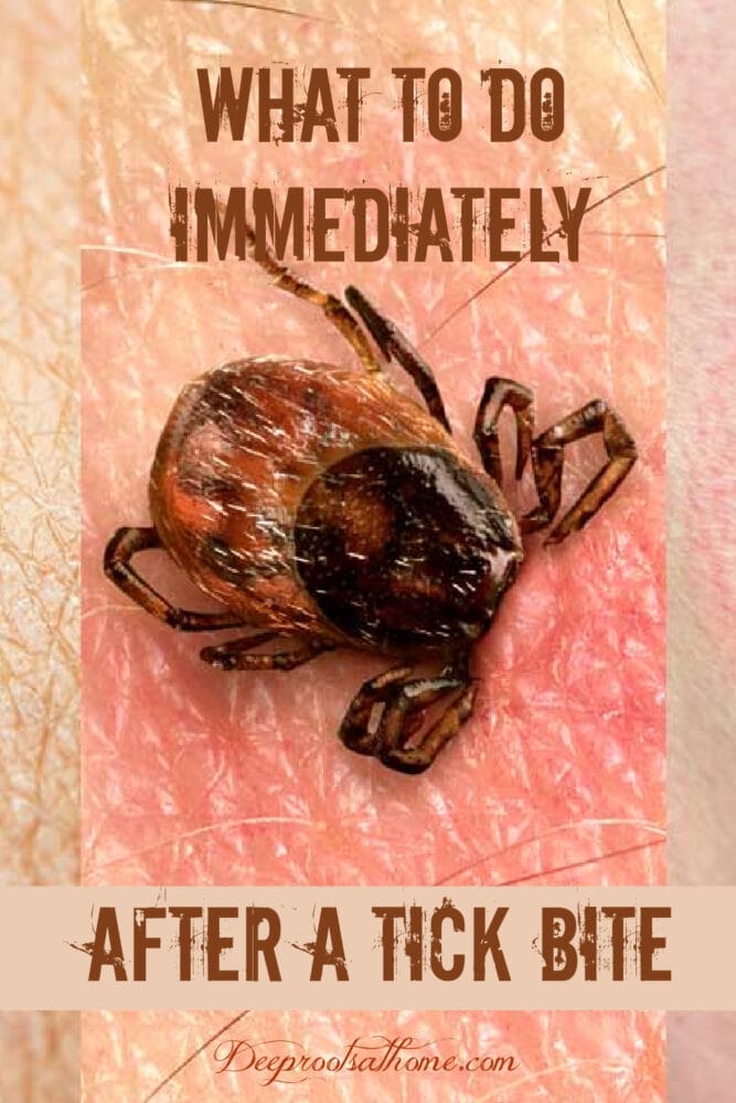 What To Do Immediately For Lyme Disease After A Tick Bite