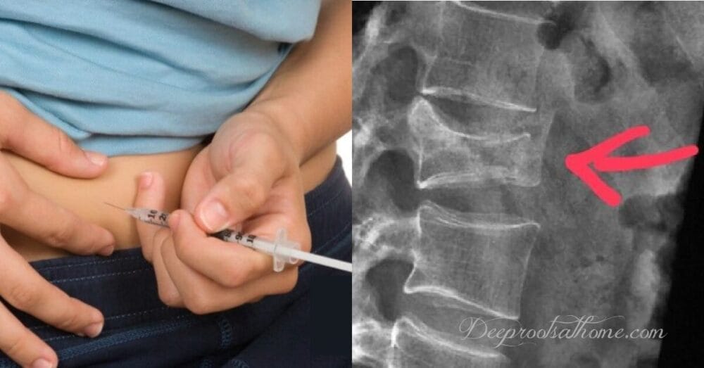 Beware: Puberty Blocker Lupron Used for Infertility Ruined Me Beware: Puberty Blocker Lupron Used for Infertility Ruined Me