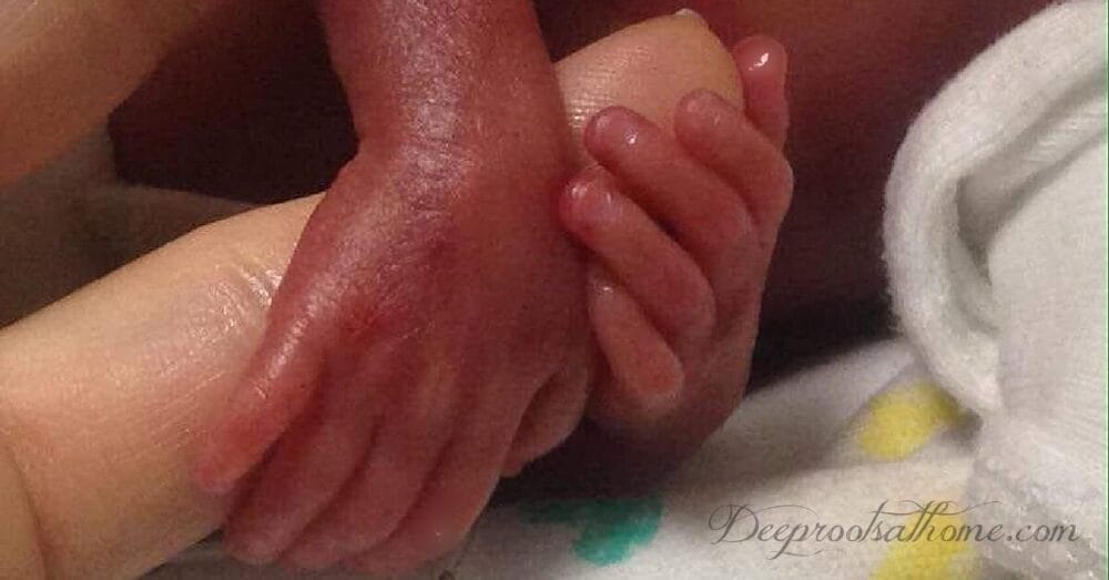 Micro-Preemie Birth Story: Keeping the Cord Uncut Saved Them