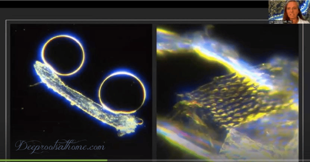 Quantum Dots in Long-acting Insulin are Building “Rubbery Blood Clots” Quantum Dots in Long-acting Insulin are Building “Rubbery Blood Clots”