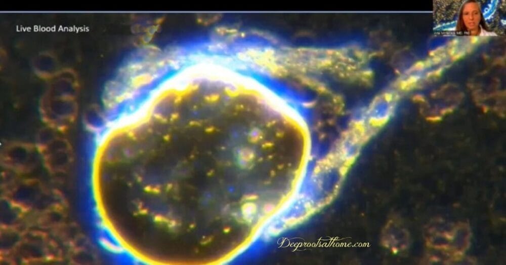 Quantum Dots in Long-acting Insulin are Building “Rubbery Blood Clots” Quantum Dots in Long-acting Insulin are Building “Rubbery Blood Clots”