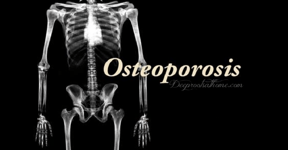 Bone Density Tests, Fosamax vs Natural Help for Osteoporosis