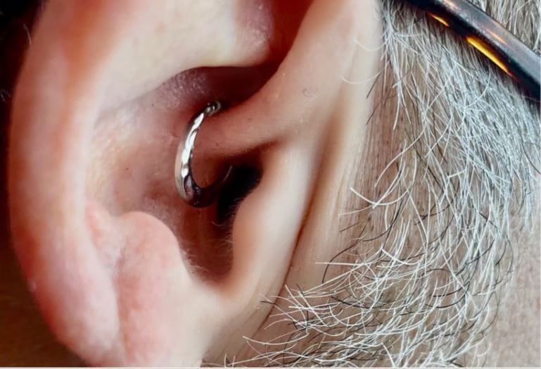 Plagued by Migraines, Jennifer's Husband Found a Piercing Cure Plagued by Migraines, Jennifer's Husband Found a Piercing Cure