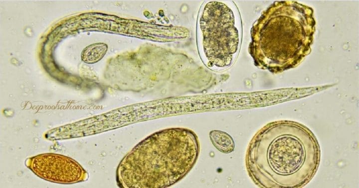 How To Support Your Body To Get Rid of A Parasitic Infection